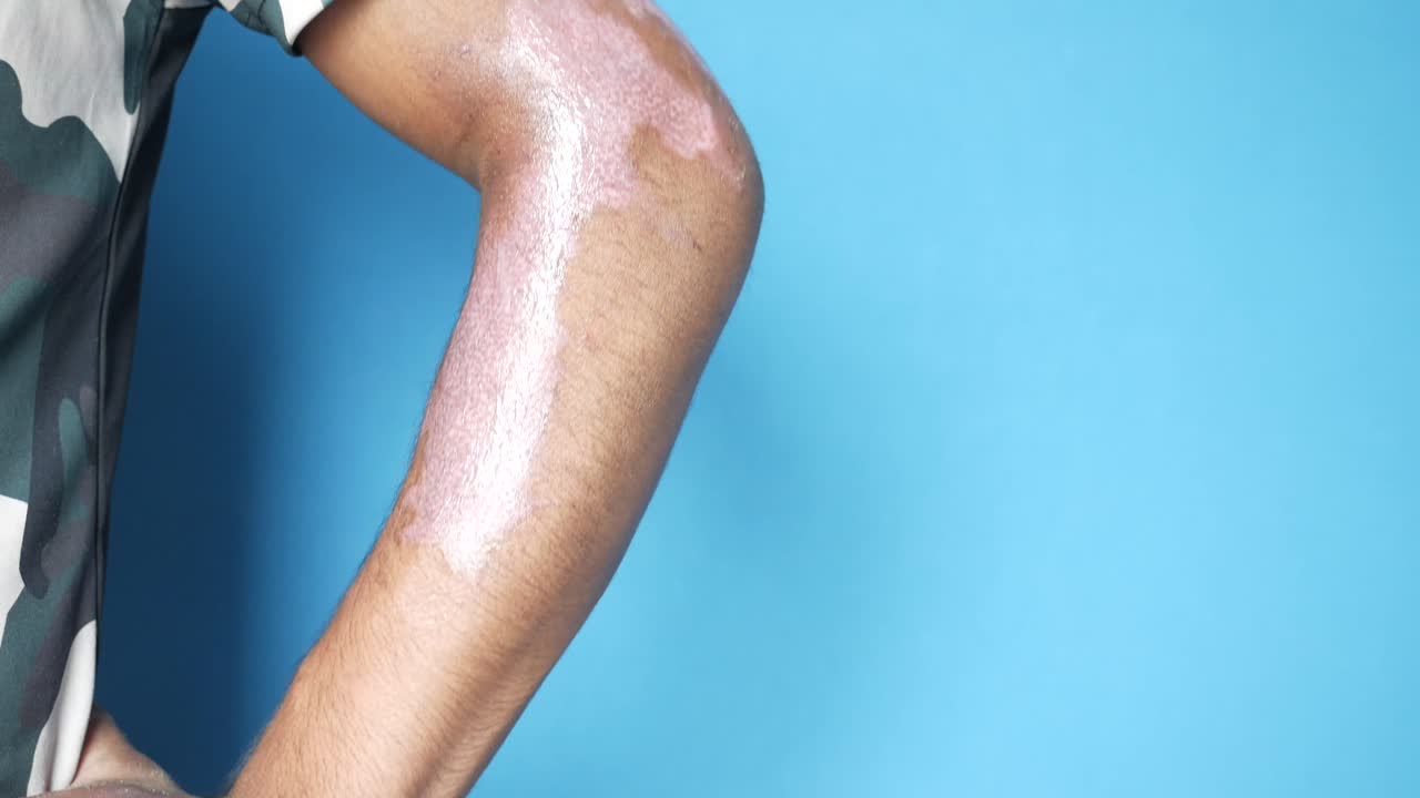 condición de la piel en el brazo