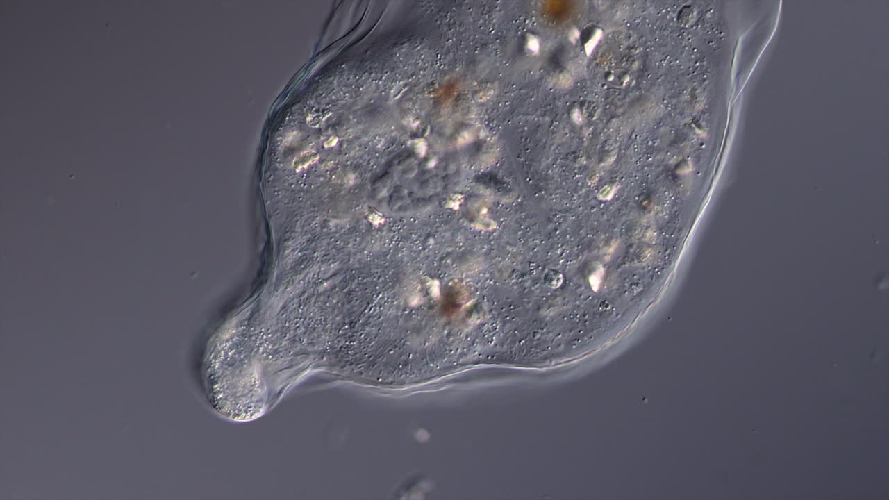 Microscopic view of a single-celled organism, possibly an amoeba or protist