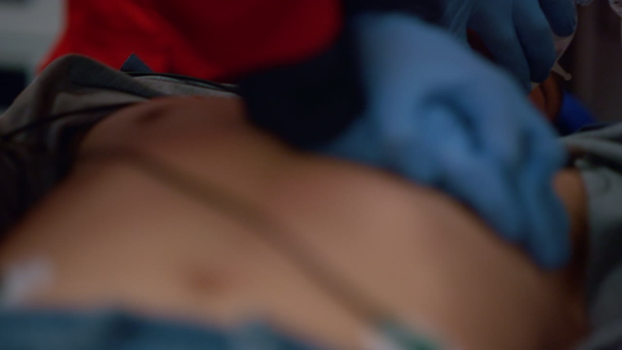 las manos de los paramédicos proporcionando masaje cardíaco en el pecho del paciente