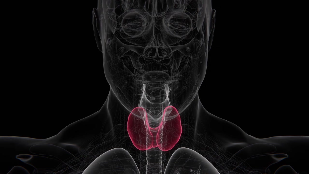 La tiroidite di Hashimoto è un disturbo autoimmune in cui il sistema immunitario attacca la ghiandola tiroidea, spesso causando infiammazione cronica e ridotta produzione di ormoni tiroidei in UHD