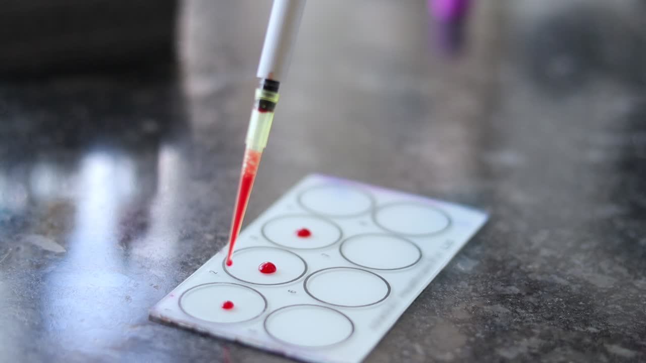 Close up of doctor hand Adding blood sample drops to glass panel using blood dropper to test blood group in the laboratory