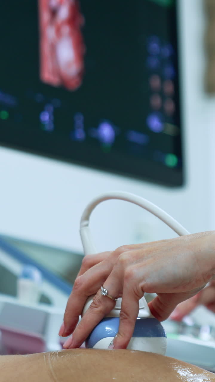 Ultrasonic check up for a Caucasain woman on early stage of pregnancy. Monitor of ultrasound machine at backdrop. Vertical video