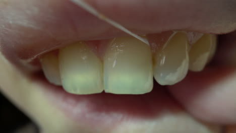 mujer limpia los dientes blancos con hilo dental a la luz brillante macro