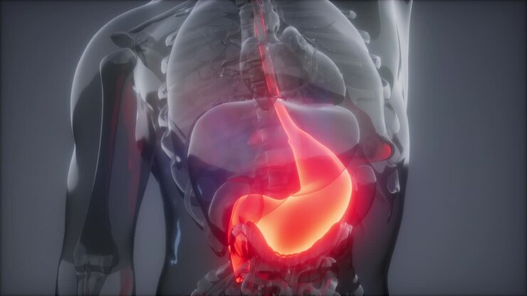Human Stomach Radiology Exam