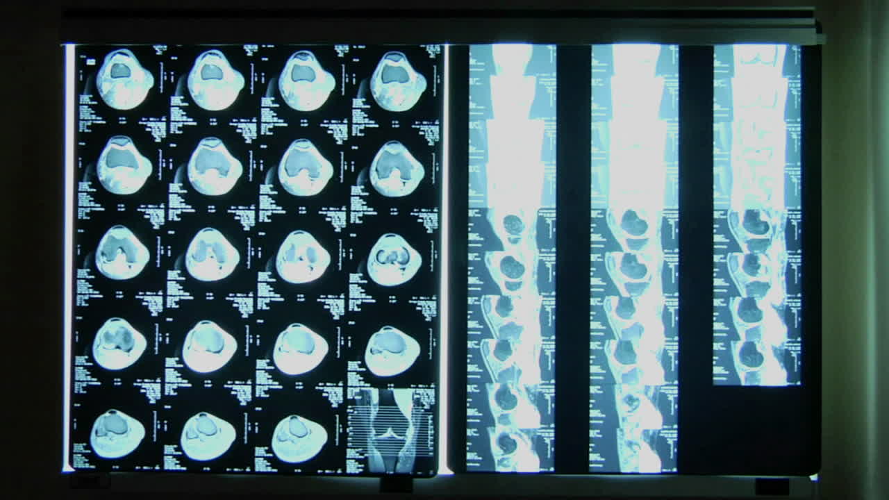 освещение освещает рентгеновские снимки на стене