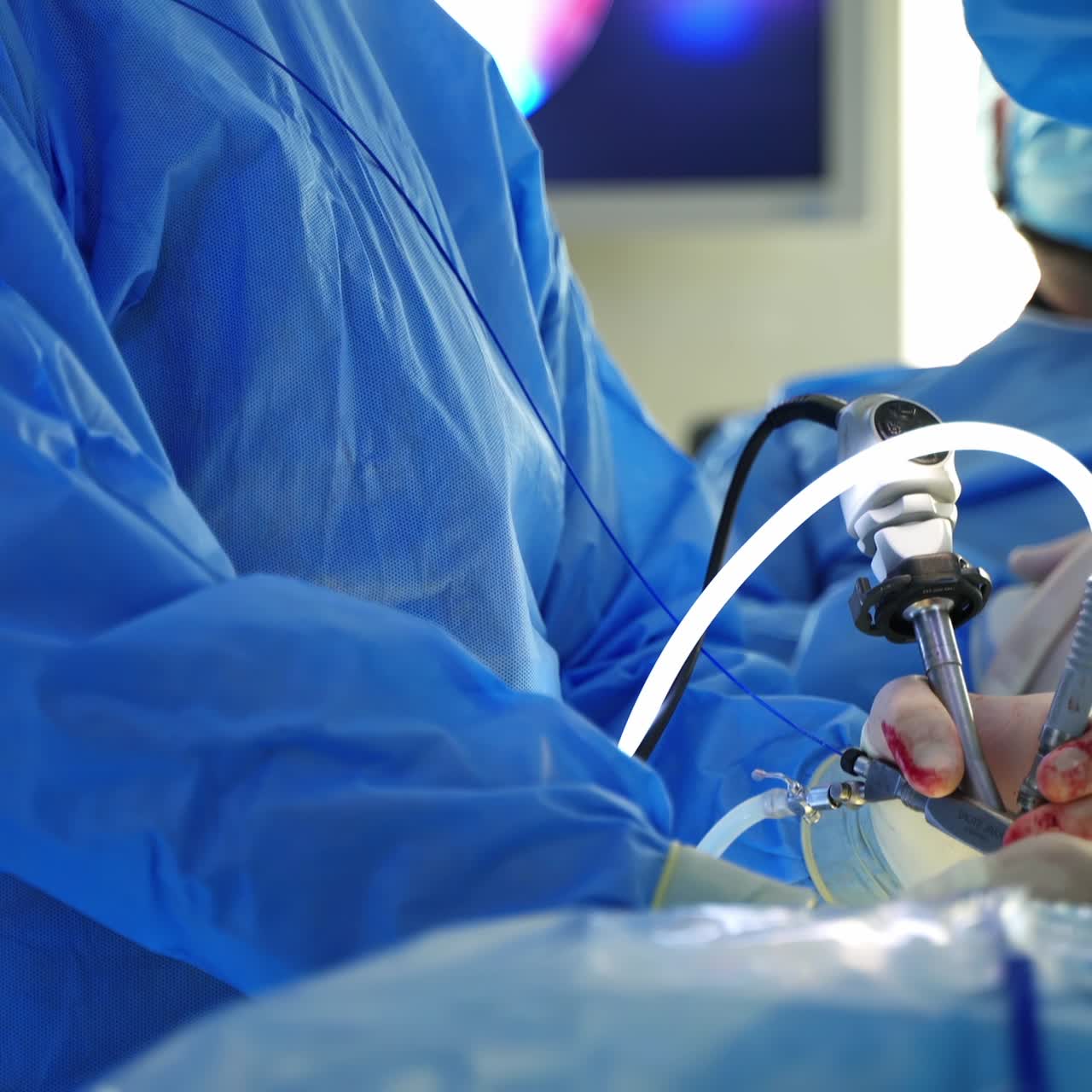 Doctor conduct a surgery with surgical instrument. Professional surgeon in blue medical uniform doing an operation and watching the process on monitor