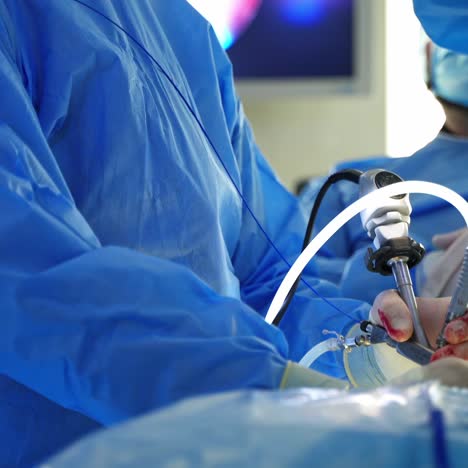 doctor conduct a surgery with surgical instrument. professional surgeon in blue medical uniform doing an operation and watching the process on monitor