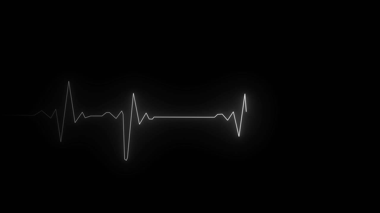 White EKG heartbeat line with multiple pulses moves across black screen. For medical drama, hospital scenes, or health concepts