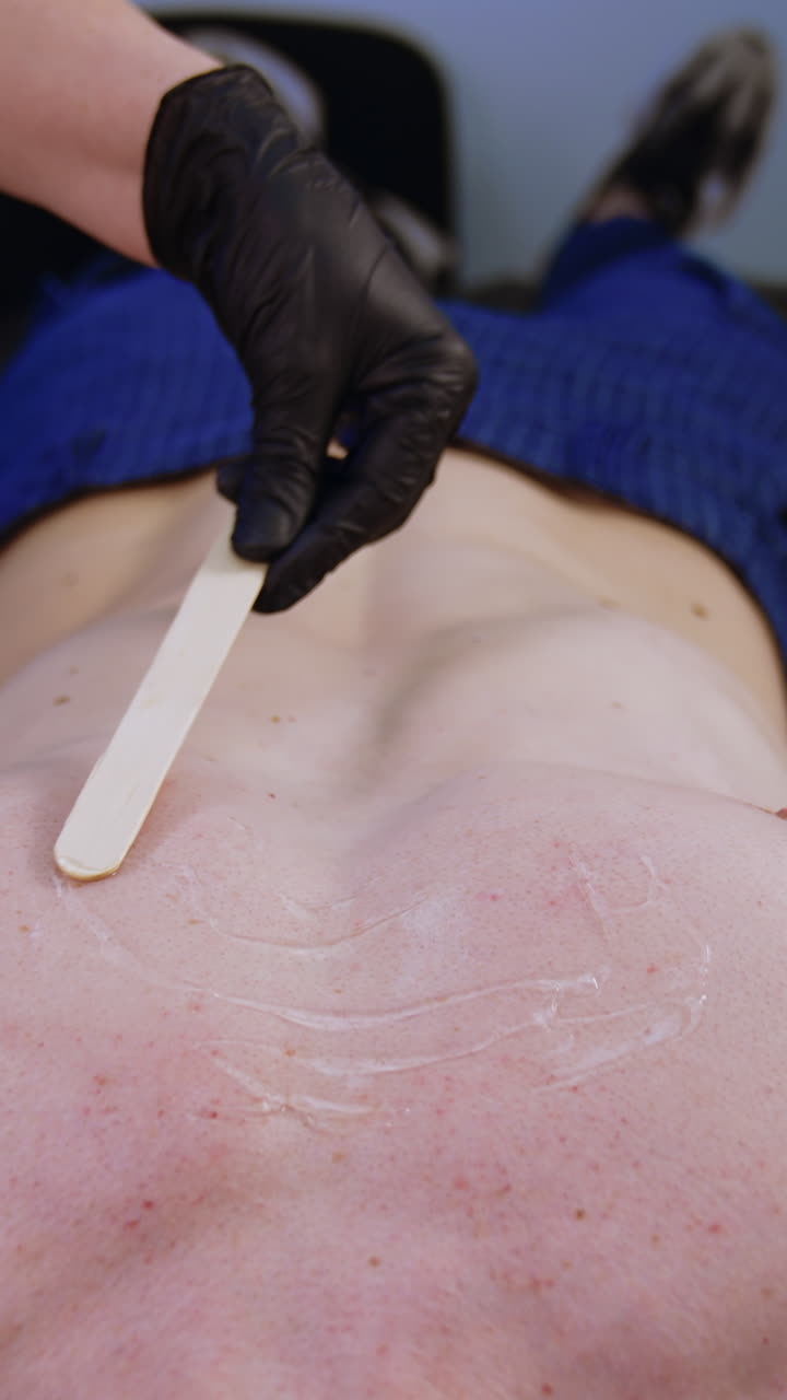 Hand of beautician in black latex glove slowly spreads gel with wooden stick. Male chest is prepared for hair removal procedure. Vertical video