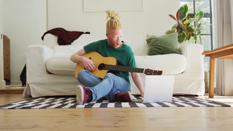 Albino-african-american-man-with-dreadlocks-playing-guitars-and-singing