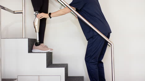 therapist assisting woman with prosthetic leg walking up stairs in clinic
