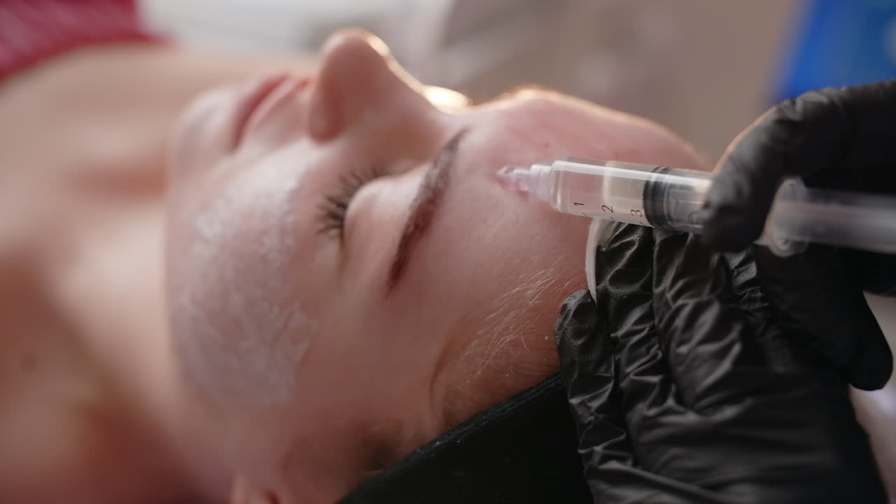 procedimiento de inyección facial