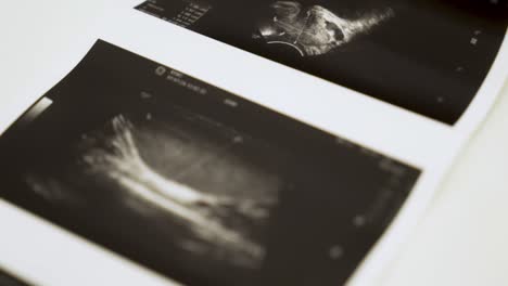 ultrasound images