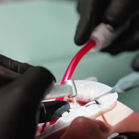 patient's face during tooth treatment at dentist's clinic. hands in black gloves of a stomatologist treating client's teeth with dental instruments. close-up.