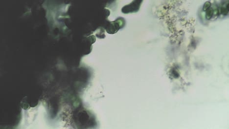 microscopic view of a dark clump of algae changing locations in the culture moving around it into and out of focus