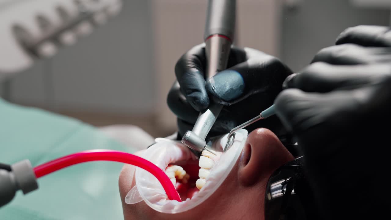 Woman at medical procedure. Close up of dentist operating patient in office