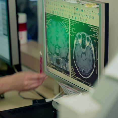 doctor examine mri results