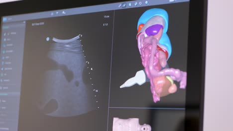 ultrasonido 3d de órganos humanos