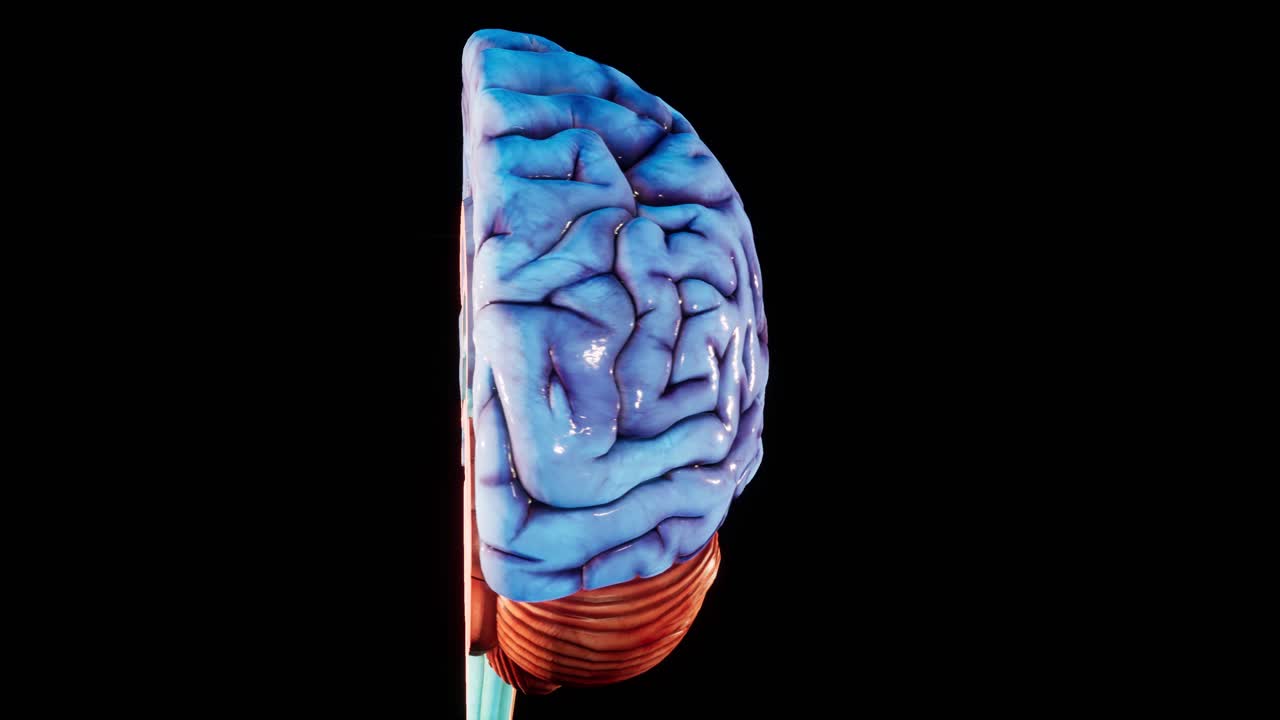 inflamación del cerebro. modelo anatómico del cerebro humano en 3d