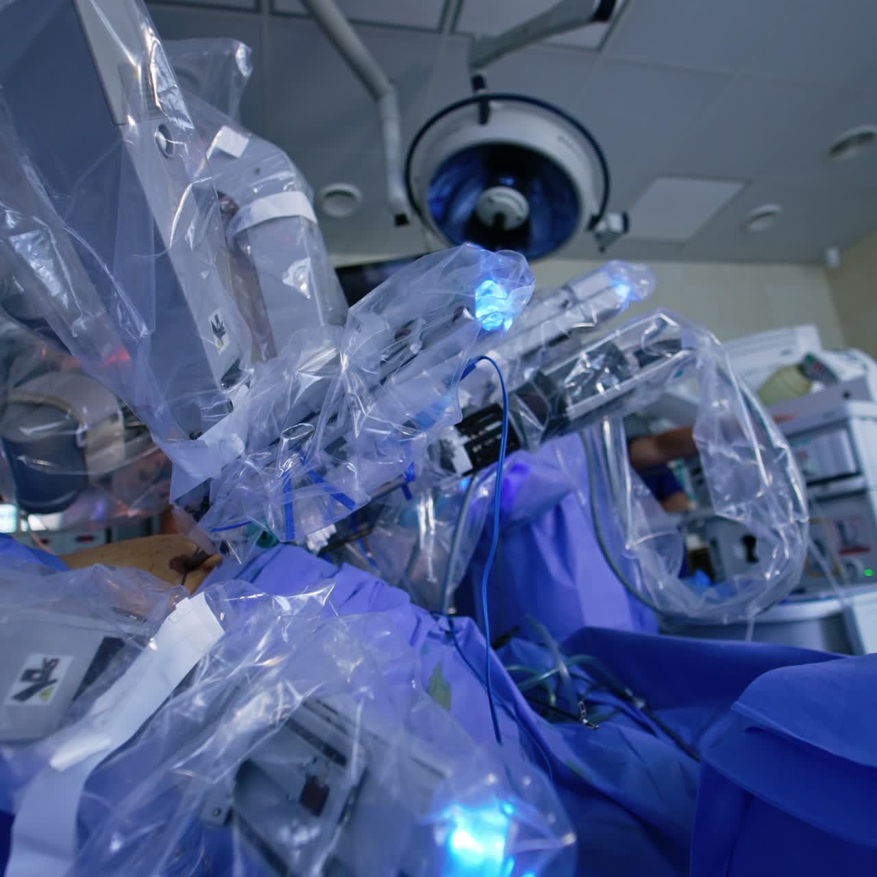 Robotic arms moving inserted into a belly of a patient. Da Vicnci surgeon system performing laparoscopy