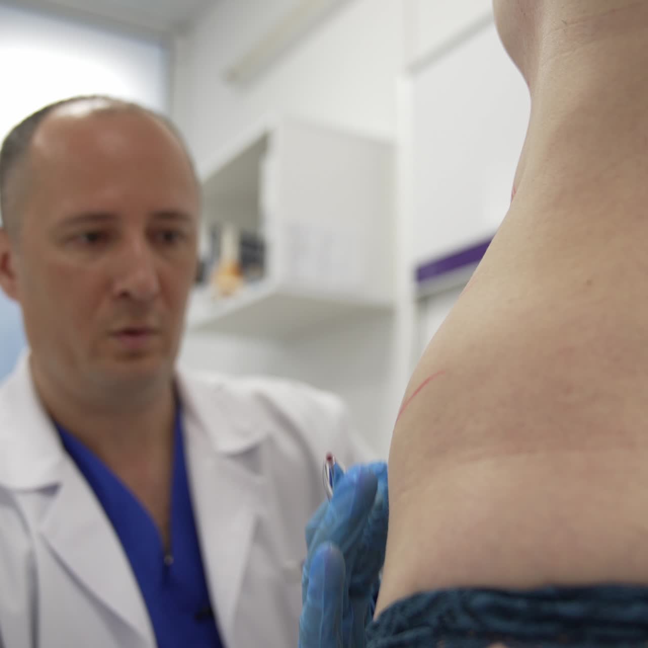 Mid-aged male surgeon marks the lines on patient's belly for future plastic surgery. Doctor comments and shows his work. Close up