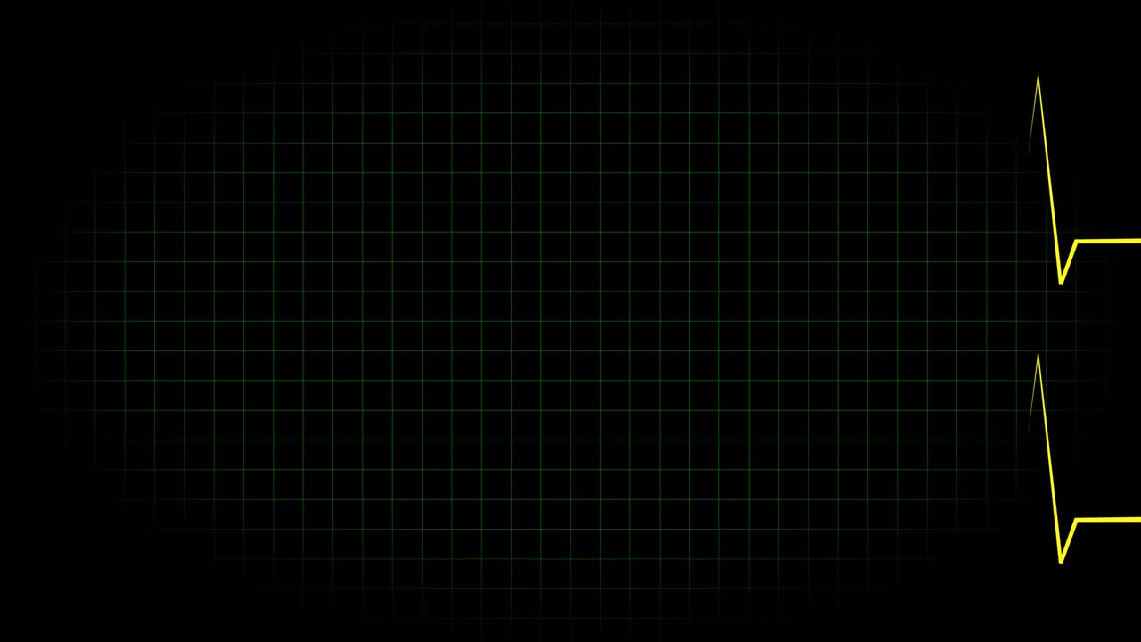 전기 심장 기록 오실로스코프 파동 형태 애니메이션 모션 그래픽