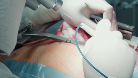 doctor with special magnifying glasses focuses on laser heart operation. surgeon uses scalpel with exacting precision during coronary artery bypass surgery to ensure patient well-being