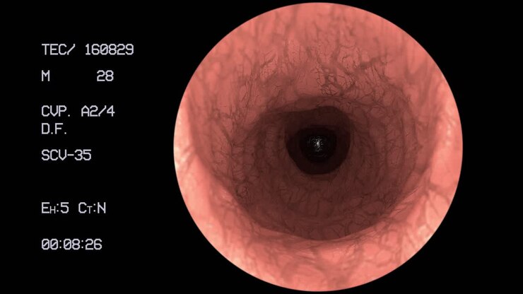 Endoscope medical camera gut intestine colon doctor endoscopy surgery 4k