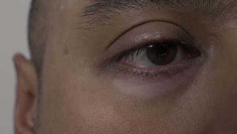 view of vitiligo underneath right eye of adult uk asian male