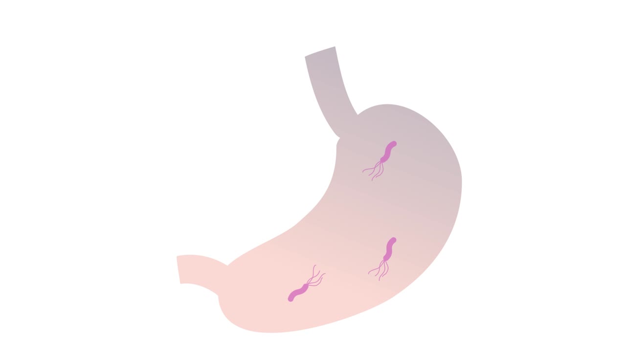 This is an animated video showing an image of H. pylori in the stomach. Loopable