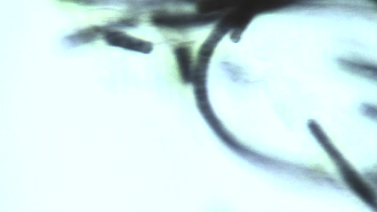 aparece una burbuja en la vista microscópica de las algas