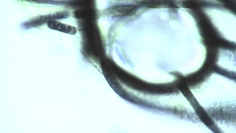 aparece una burbuja en la vista microscópica de las algas