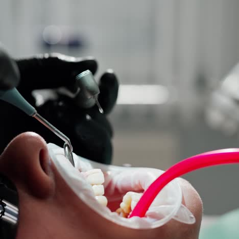 tooth treatment. face of a patient with opened mouth during orthodontic process. drill machine and dental tools in stomatologist's hands. close-up.