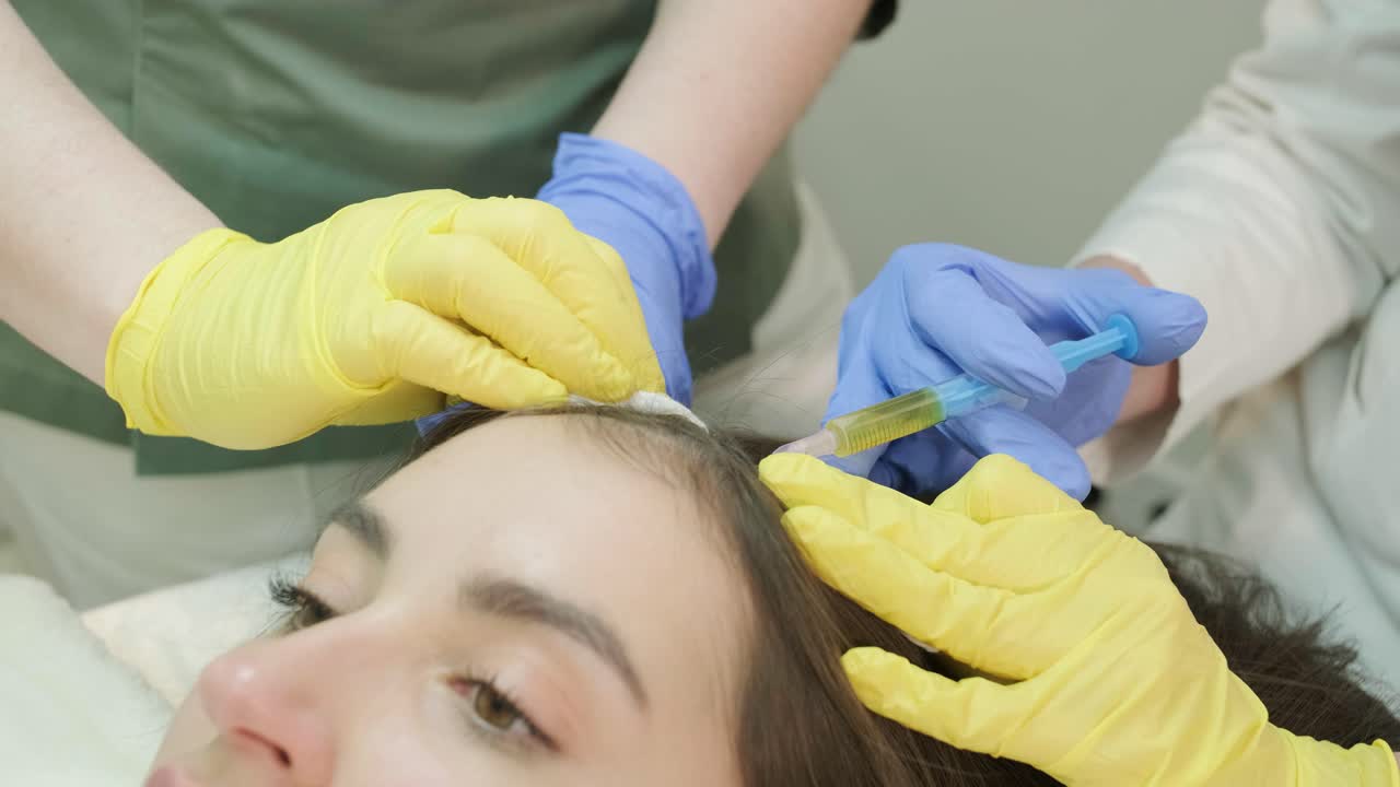 tratamiento con plasma del cuero cabelludo. procedimiento de mesoterapia capilar en la clínica de cosmetología moderna