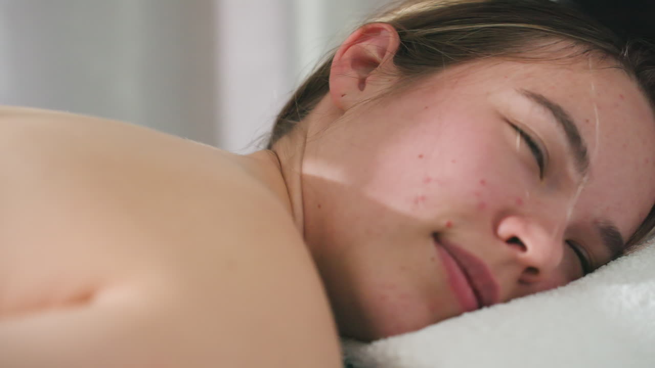 Close up of female client resting head on folded towel, enjoying therapy session with calm expression while natural skin texture and red facial spots are visible in bright indoor wellness setting