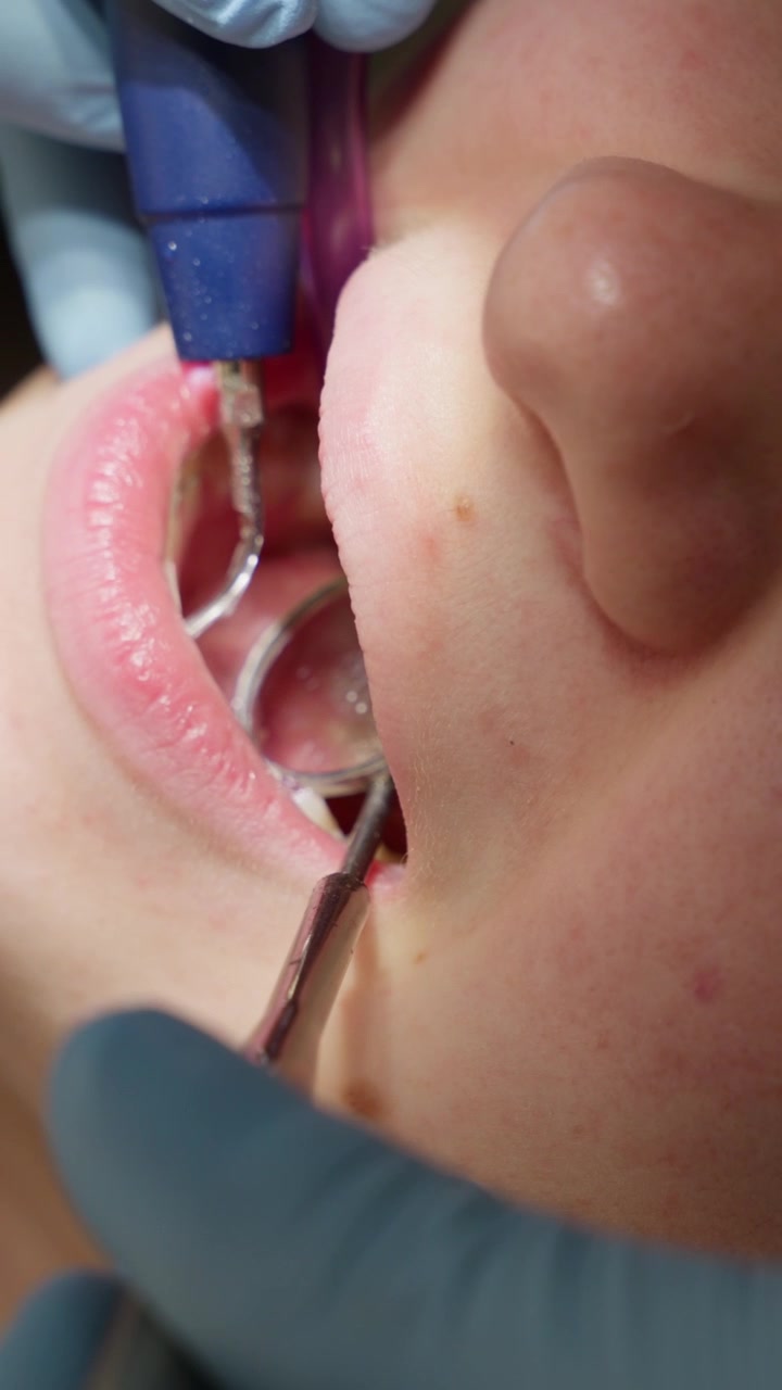 Dentist Performing Dental Cleaning Procedure on Patient