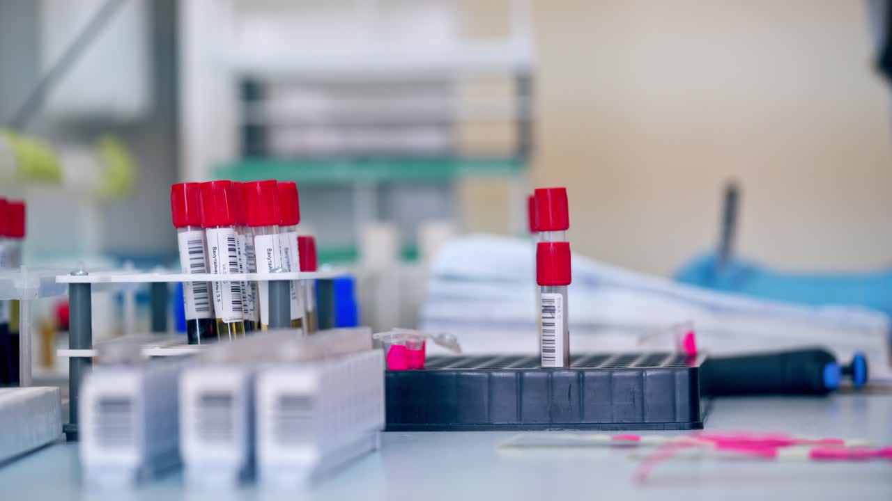 Covered vials with liquid in the laboratory. Test tubes on special support on the table on blur background of a female writing the results.