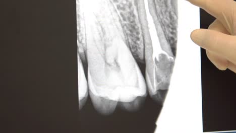 dental x-ray examination
