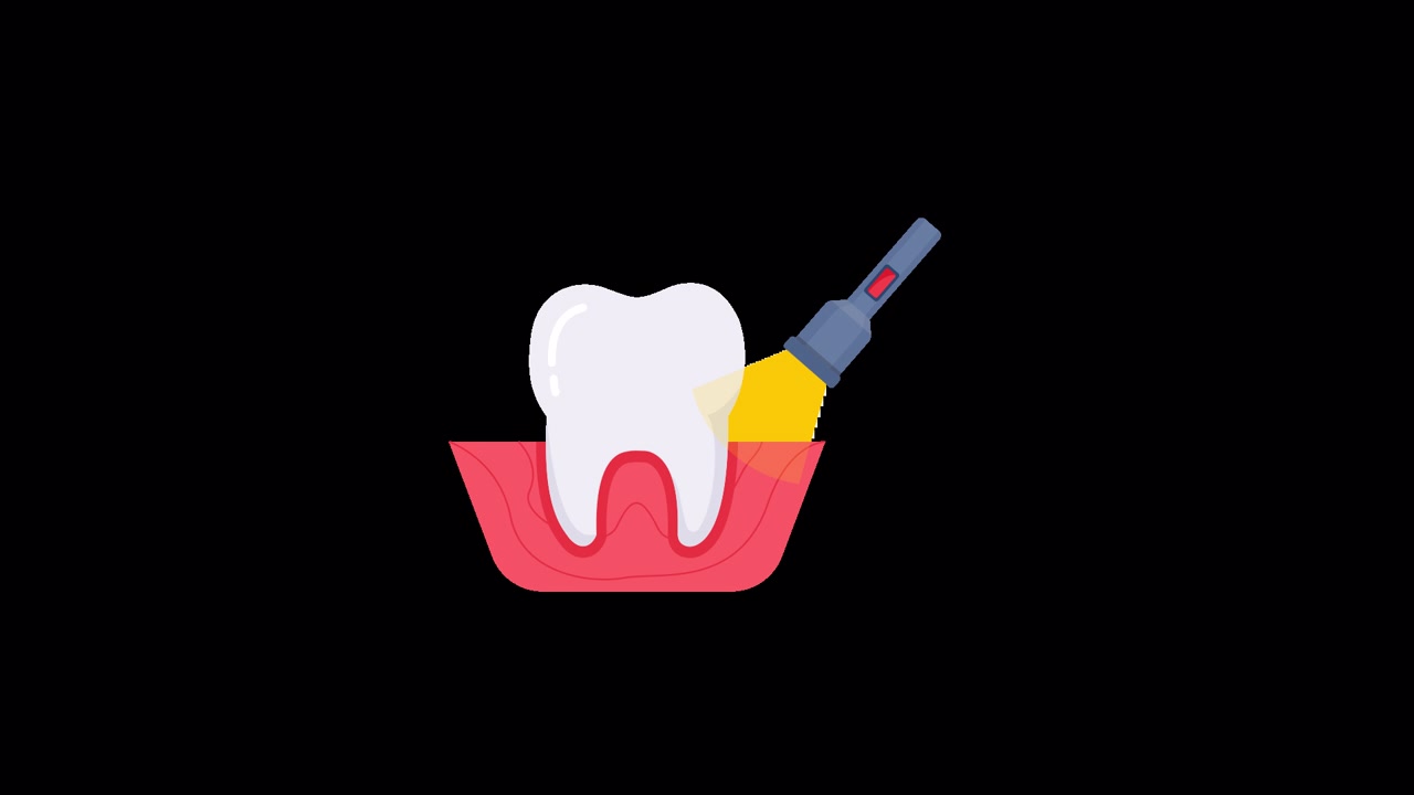 Animated Dental Tooth Treatment with Light Tool