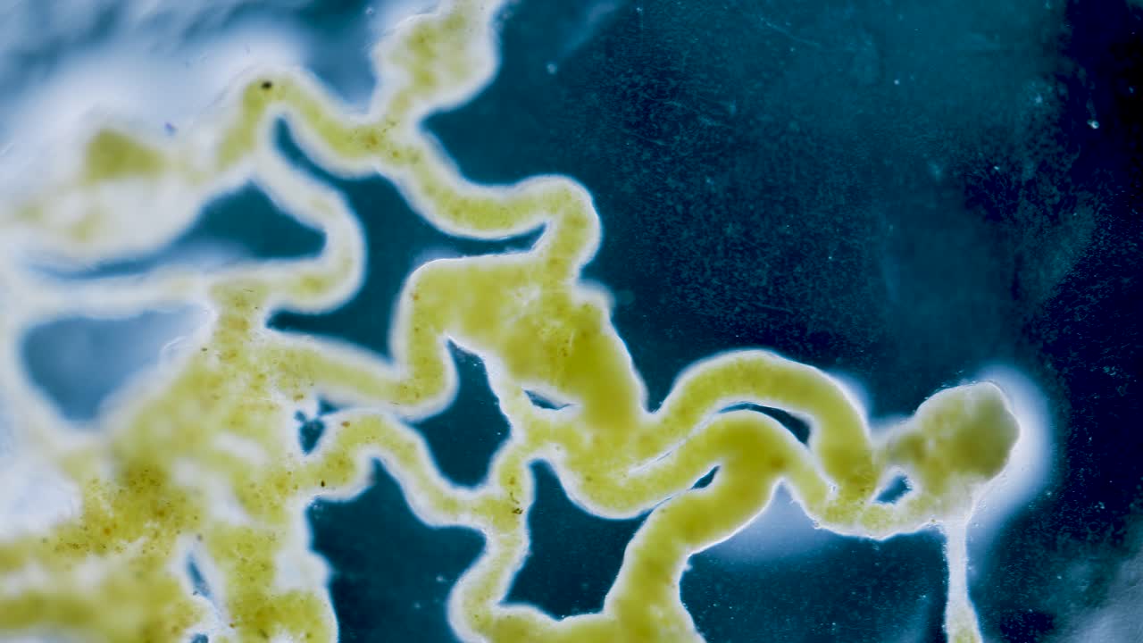 Slime mold plasmodium under microscope