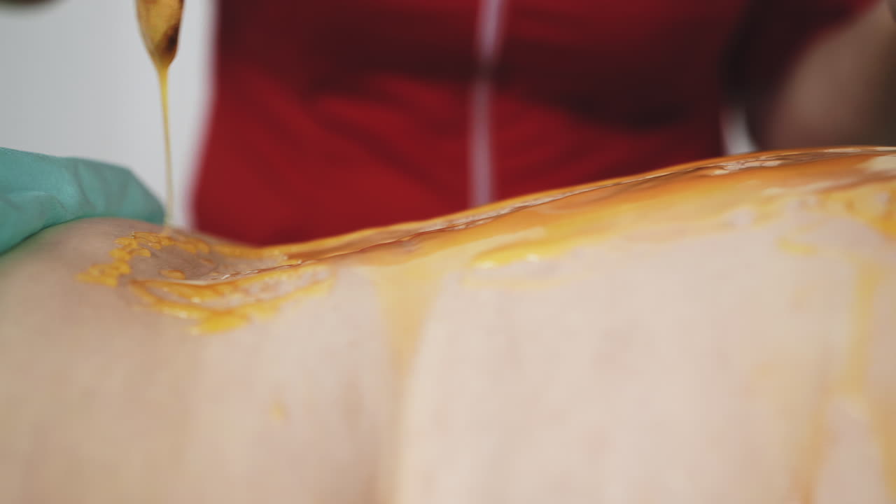 el terapeuta aplica miel en la espalda de la paciente para el masaje.