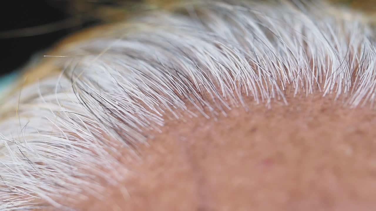 Close-up of grey and black hair on a scalp