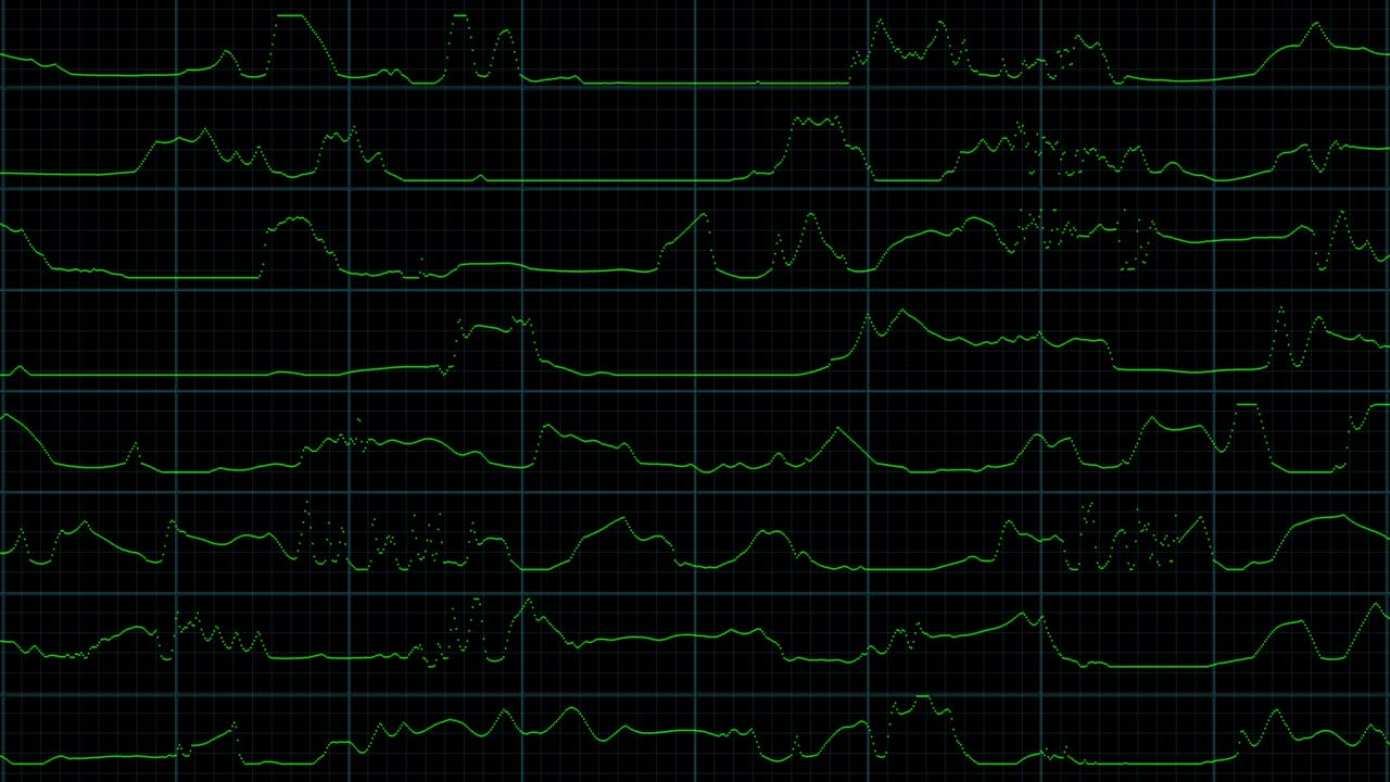 비디오 테이프 추적 결함 모드, 컬러 다이내 노이즈 모션, 검은 바탕의 오래된 영화 그런지, 현실적인 박거림