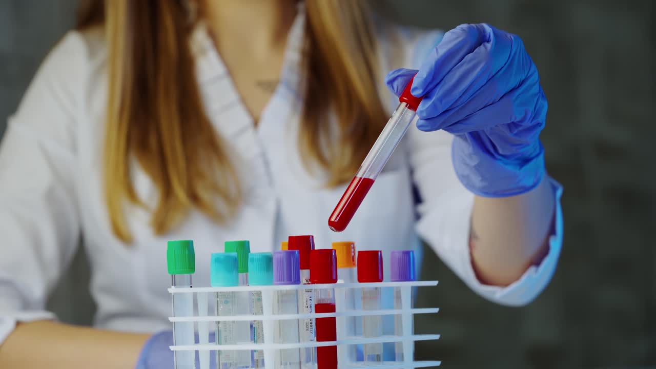 Blood sample tubes. Doctor hand taking a blood sample tube from a rack with machines of analysis in the lab