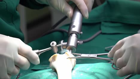 Surgeons perform an intricate orthopedic procedure focusing on bone repair using specialized tools in a sterile environment. This operation highlights advanced surgical techniques and teamwork.
