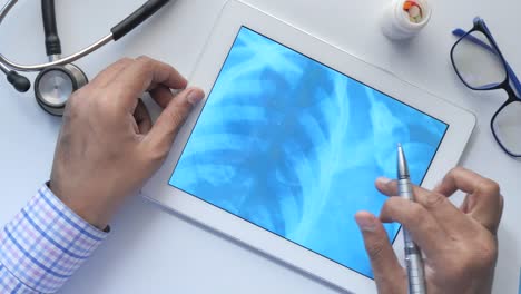 doctor reviewing a chest x-ray on a tablet