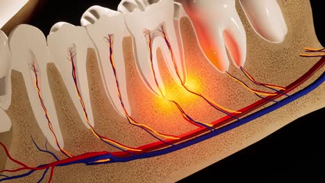 dolor de dientes. sección anatómica detallada de los dientes. inflamación del nervio. animación en 3d