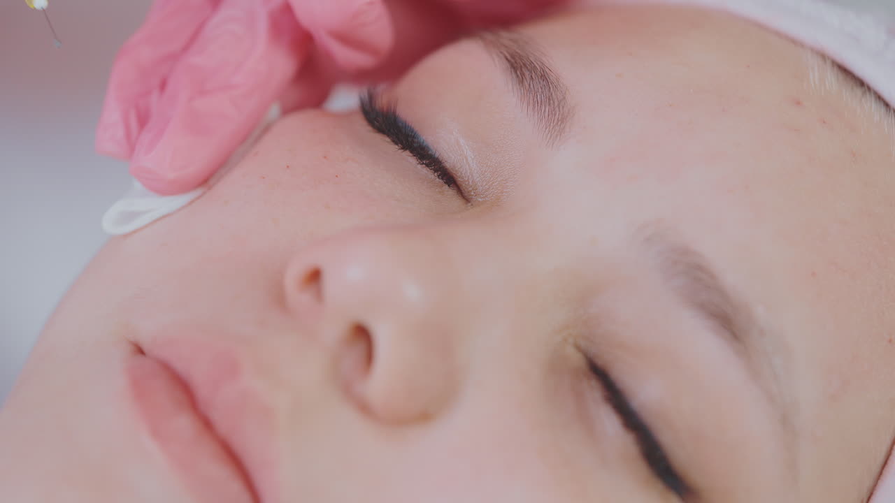 tratamiento por inyección facial