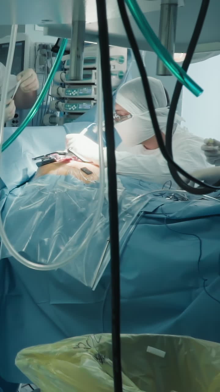 el médico aplica una tira de parche durante la cirugía cardíaca en la habitación. el equipo de cardiólogos realiza una cirugía de derivación de la arteria coronaria a un paciente enfermo en el hospital