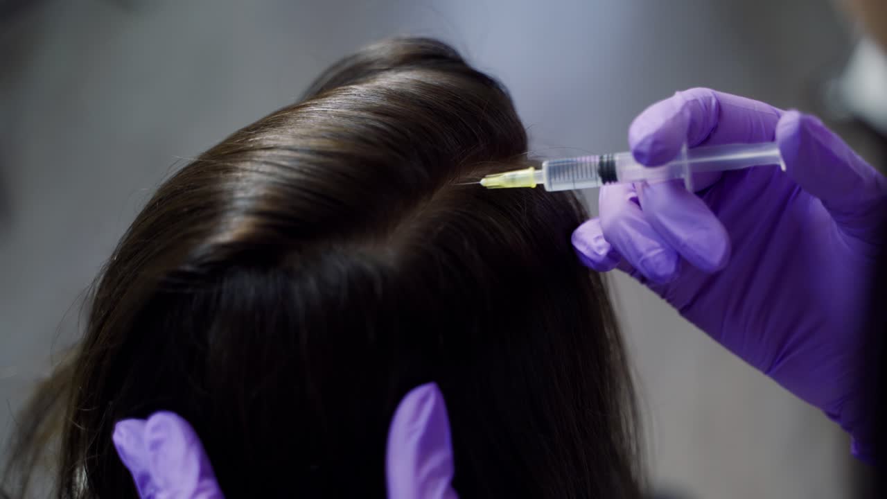 A beautician conducts mesotherapy for hair in gloves with using a professional medical product in the cosmetology center. Close-up.